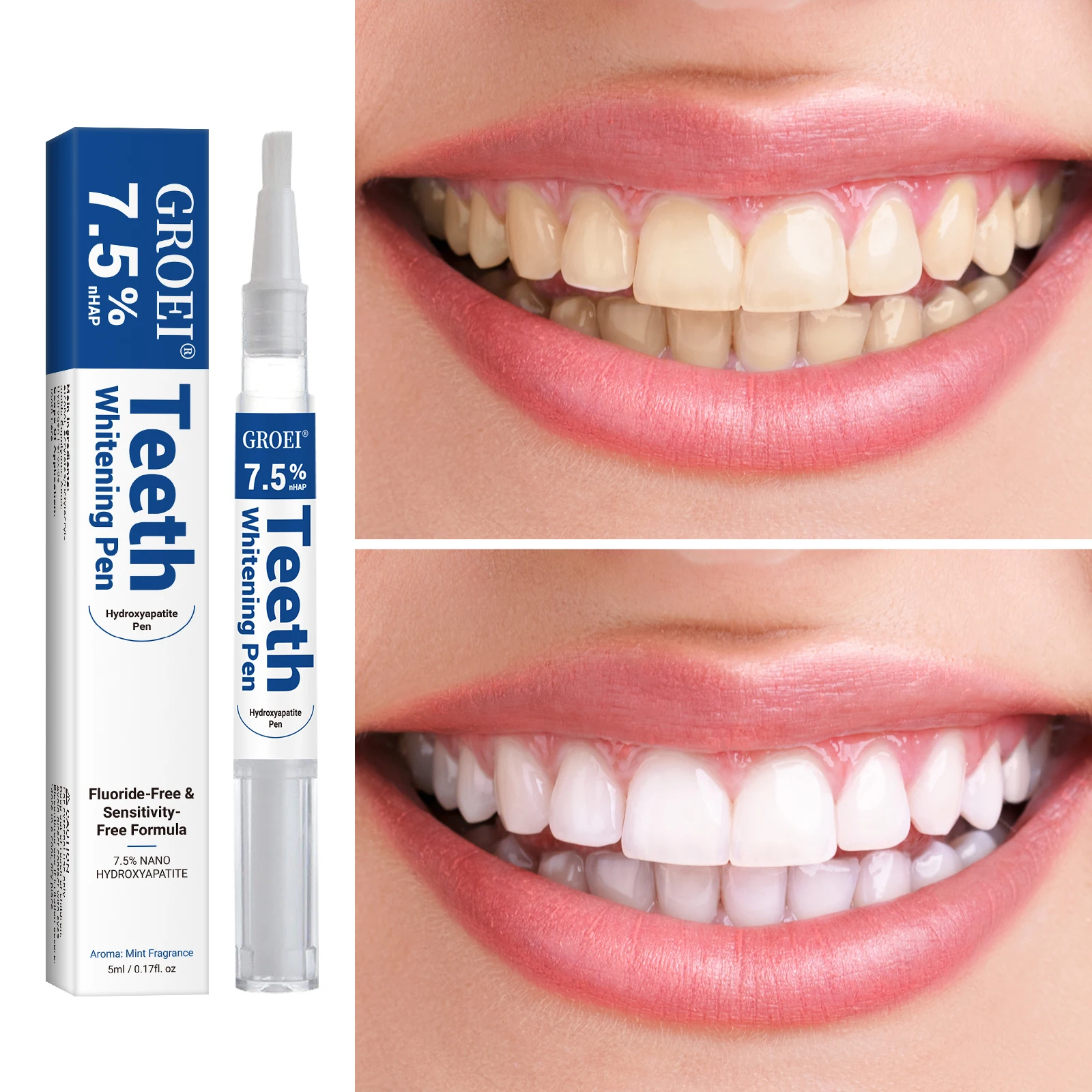 Hydroxyapatite Tooth Whitening - đánh giá và giá Teeth Whitening Hismile