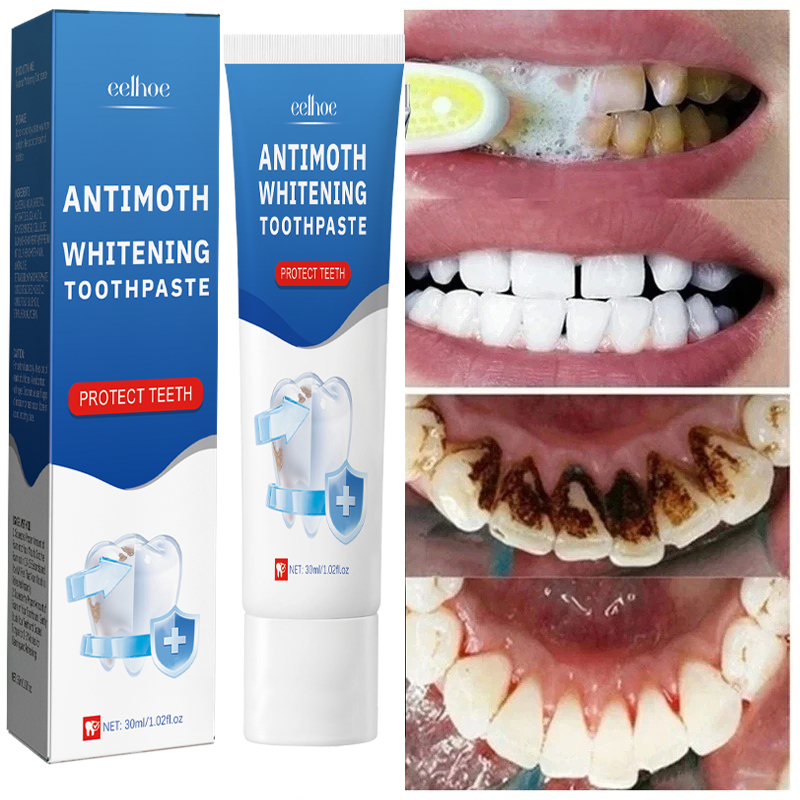 Fast Remove Smoke Stains Tooth - đánh giá và giá Teeth Whitening Fast