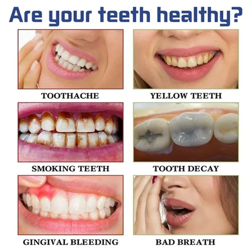 Fast Remove Smoke Stains Tooth - đánh giá và giá Teeth Whitening Fast