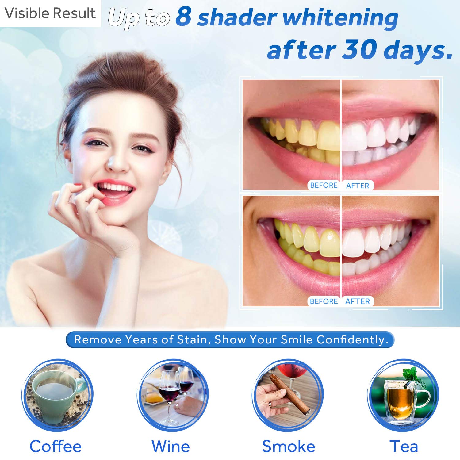 Teeth Whitening Gel Refill Syr - đánh giá và giá Teeth Whitening Gel Refills