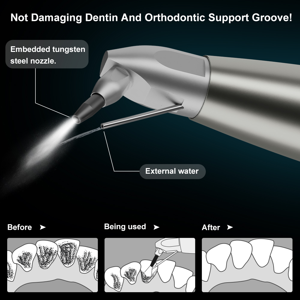 AI-AP3-K/N Dental Air Abrasion - đánh giá và giá Colgate Whitening Teeth
