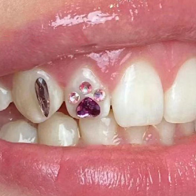 4Pcs Dental Tooth Gems Crystal - đánh giá và giá Tooth Gem Kit
