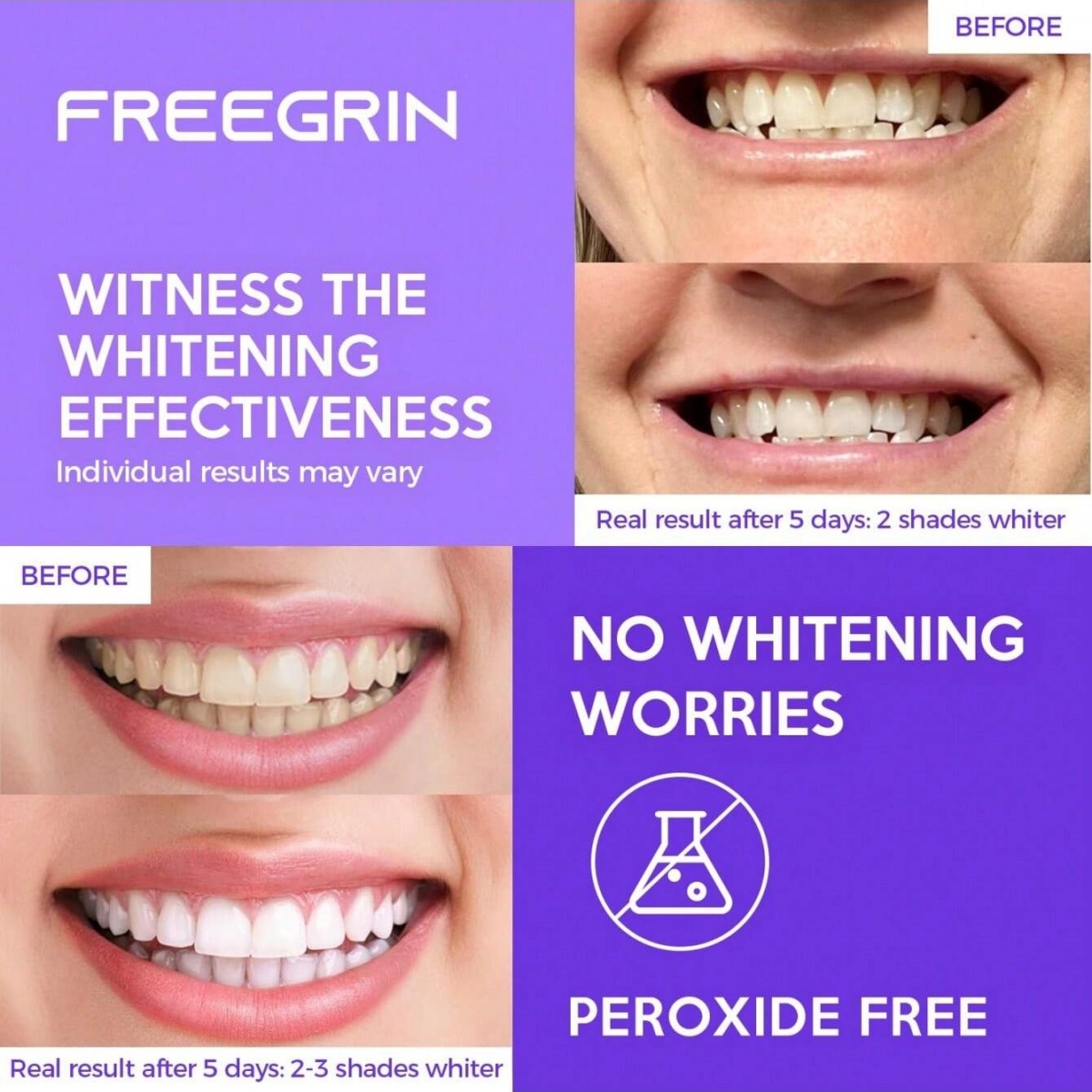 Deluxe Whitening Teeth Sticker - đánh giá và giá Teeth Whitening Hismile